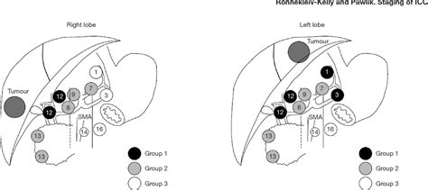 Figure 2 from Staging of intrahepatic cholangiocarcinoma. | Semantic ...