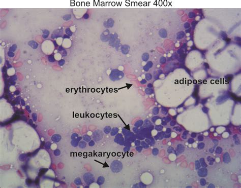 Bone marrow 400x « Dissection Connection