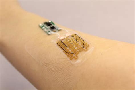 Smart Bandages Designed To Monitor And Tailor Treatment For Chronic ...