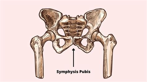 Symphysis Pubis Dysfunction: Causes, Symptoms & Treatment for it