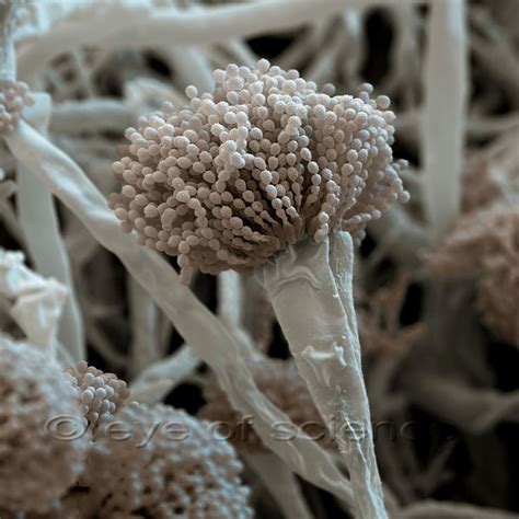 Bacteria and Fungus seen in the Scanning and Transmission Electron ...