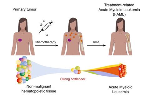 Cancer chemotherapy side-effects on blood cell development • healthcare ...