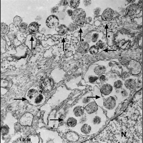 Closer look of Mycoplasma genitalium infection. (Source: Author using ...