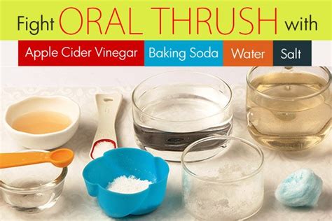 Home Remedies for Oral Thrush - Page 2 of 3 | Top 10 Home Remedies