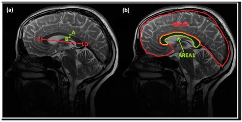 Applied Sciences | Free Full-Text | Assessment of the Central Nervous ...