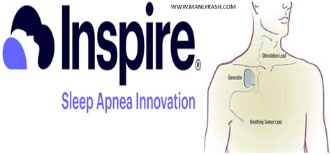 Inspire Sleep Apnea - We Care Your Lifestyle