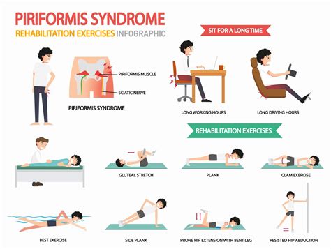 Piriformis Syndrome - Chiropractor - Harmony Chiropractic