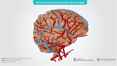 Human Brain Sculpture