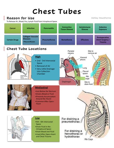 Chest Tubes - cram - High 2nd - 3rd Intercostal Space Removal of Air ...