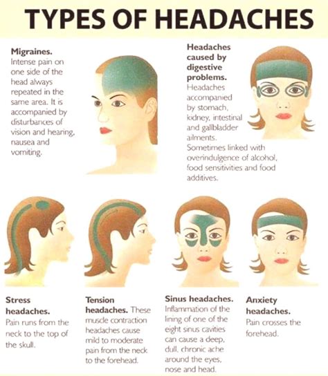 #headaches #types #more #of Types of Headaches … | Headache types ...