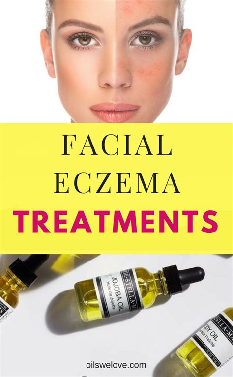 Best natural treatments for eczema on face Clear Skin Remedies, Home ...