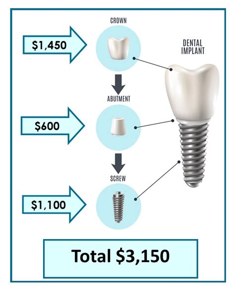 Dental Implant FAQs in Cincinnati, OH | Total Dentistry