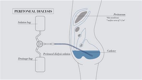 Peritoneal Dialysis Ati Template