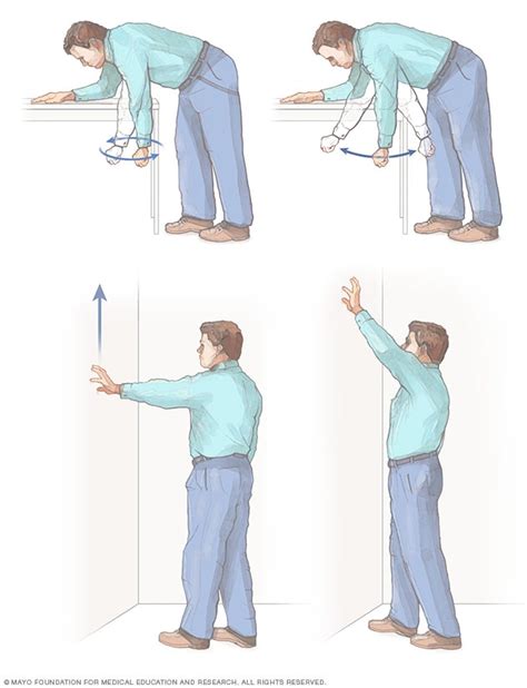 Frozen shoulder - Diagnosis and treatment - Mayo Clinic