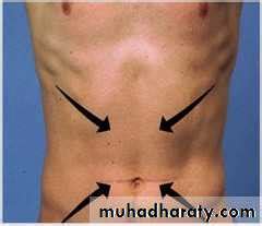 spinal cord 3 pptx - فرح نبيل عباس - Muhadharaty