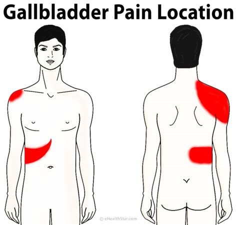 Gallbladder Pain Location Diagram, Symptoms, Causes, Relief - eHealthStar