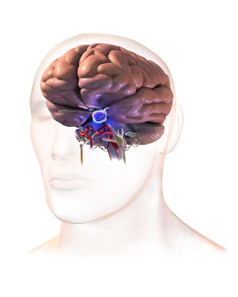 What Is a Pituitary Brain Tumor? My Symptoms and Experience of a ...