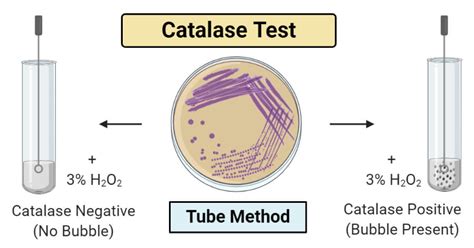 Catalase Test- Principle, Procedure, Types, Results, Uses