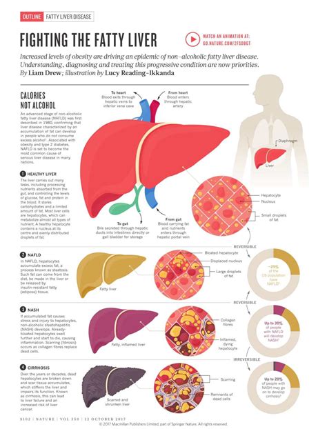 Understanding Fatty Liver Disease and Its Treatment Protocol - Infographic