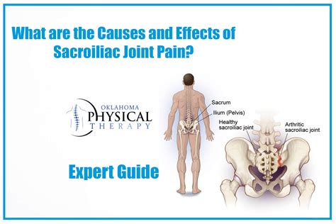 Causes and Effects of Sacroiliac Joint Pain? Expert Guide – Oklahoma ...