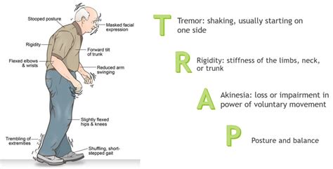 Parkinson’s Disease (PD) Free Trial - Pass The OT