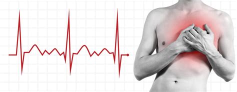 Fast Heart Rate - Symptoms, Causes and Treatments • MyHeart