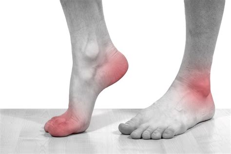 Foot Pain Treatment | Common Causes of Foot Pain