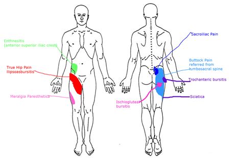 Hip Pain – New Hope Family Chiropractic