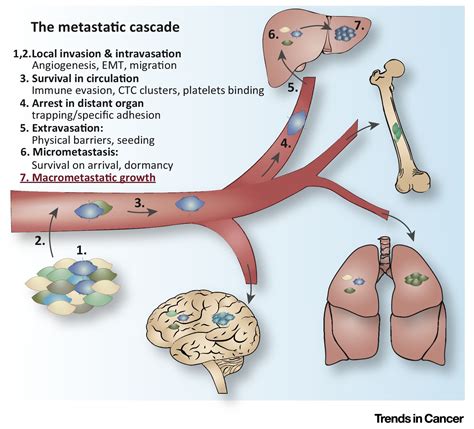 Surviving at a Distance: Organ-Specific Metastasis: Trends in Cancer