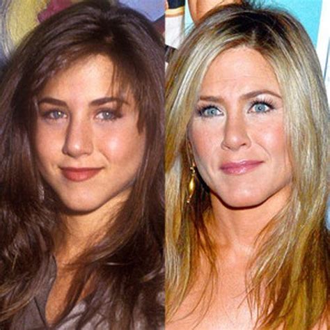 Celebrities Who Got a Nose Job to Fix Their ''Deviated Septum ...