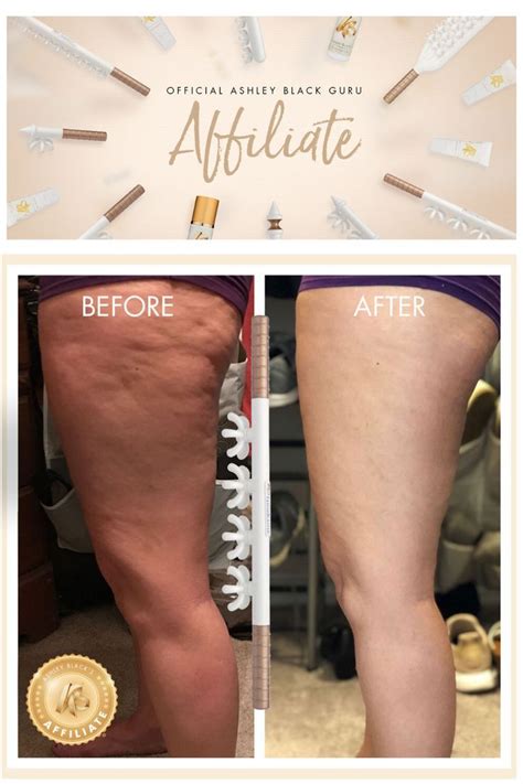 Here are the benefits: All the benefits of FasciaBlasting Full body ...