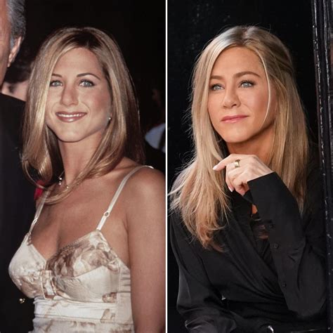 Jennifer Aniston Has Been Open About Her Plastic Surgery — Learn What ...