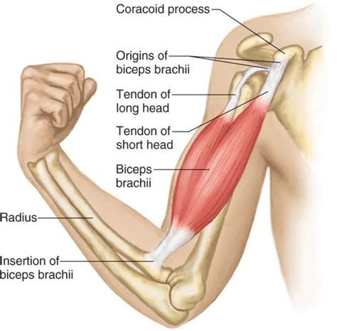 Bicep Tendonitis: What Causes The Pain and How To Fix It - Gymless