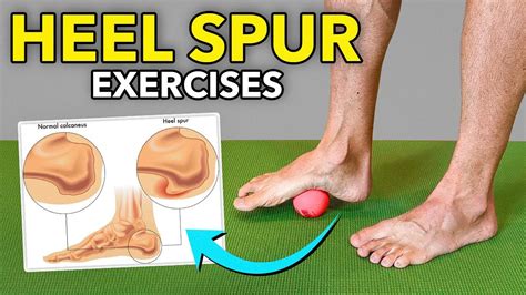 Plantar Spur Treatment Top Sellers | www.medialit.org