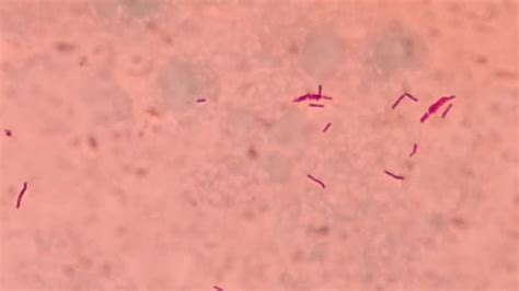 Mycobacterium Tuberculosis Shape