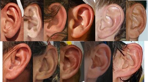 Punnett's Square: Attached Earlobes: The Myth