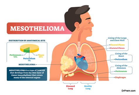 The Dangers of Asbestos: Everything You Need to Know