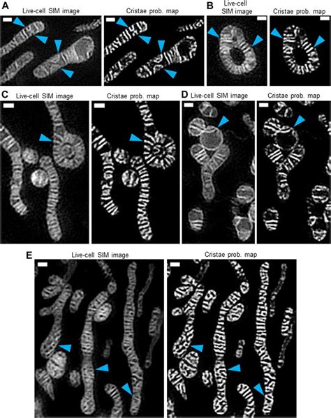 Quantification of cristae architecture reveals time-dependent ...