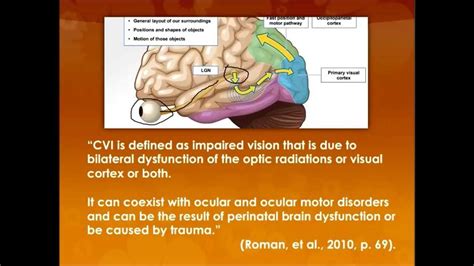 Cortical Visual Impairments - YouTube | Cortical visual impairment ...