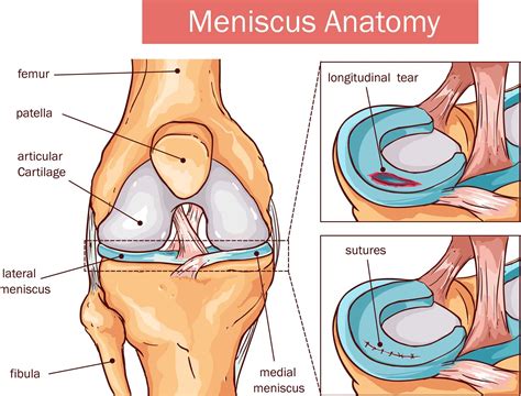 Knee Meniscus Surgeries | Aptiva Health