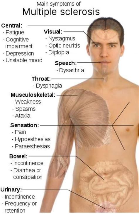 MS & the body Bladder Incontinence, Optic Neuritis, Ms Project, Ms ...