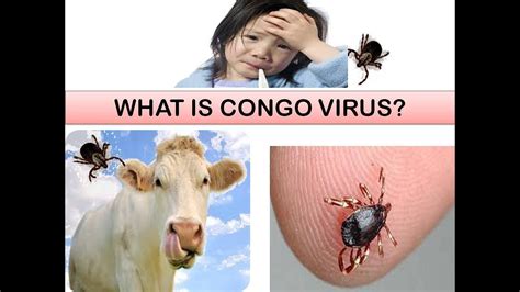 Congo Virus | Life Threatening Virus - YouTube