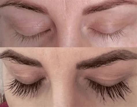 Want an Eyelash Growth Serum That Works? 7 Key Things to Look For