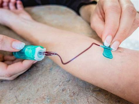 Tips on butterfly needles : r/phlebotomy