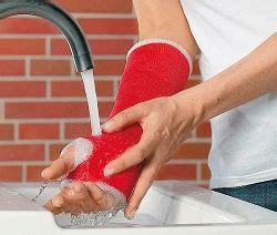 Waterproof Cast - Direct To Patients | Waterproof casts, Arm cast, It cast