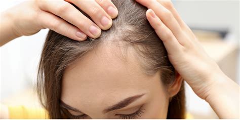 Alopecia Treatments | San Luis Obispo | Coastal Dermatology