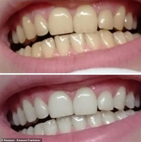 Deal alert! The bestselling Crest teeth whitening strips will whiten ...