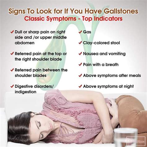 Simptomts-gallstones | Gallstones, Gallbladder symptoms, Gallbladder