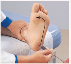 Initiating the Plantar ReflexHave the subject remove a ... | Chegg.com