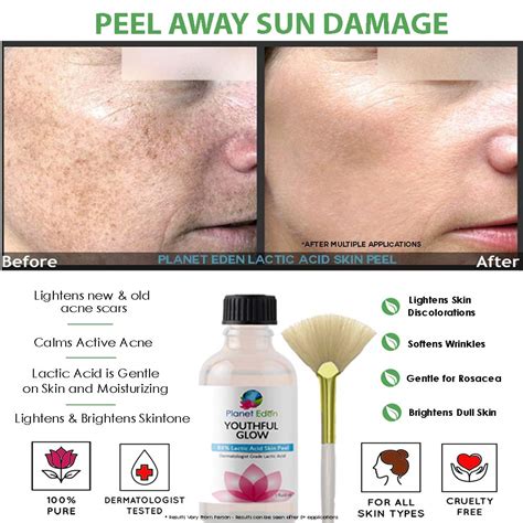 Intense Repair 88% Lactic Acid Skin Peel Kit with Antioxidant Repair ...